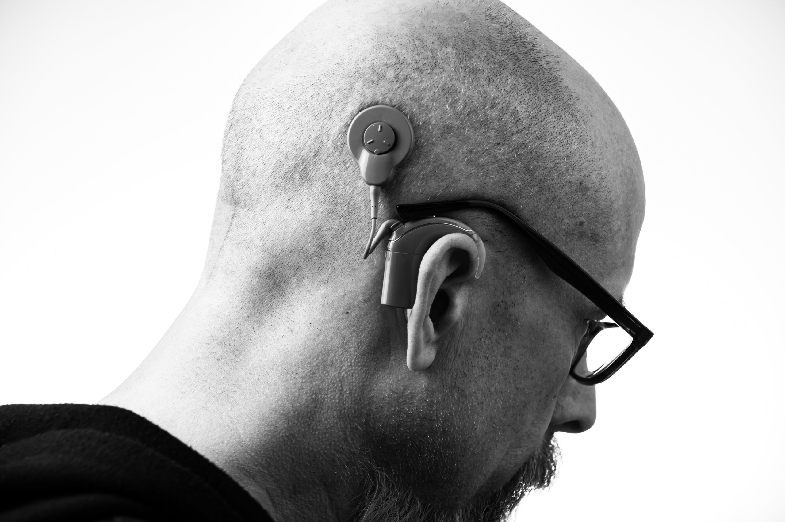 This pictures shows a cochlear implant being used to hear better.